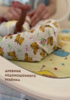 Дневник недоношенного ребёнка